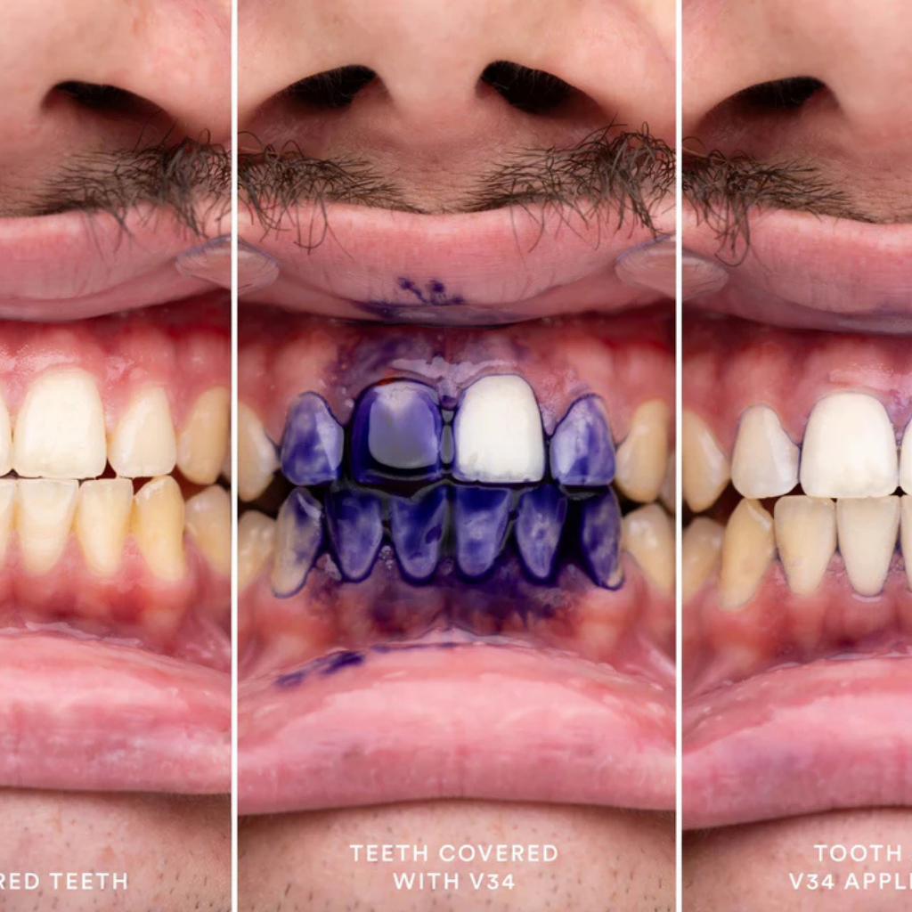 Hismile V34 – Sérum Blanchissant pour Dents 30ml